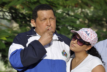 Compleja la recuperación de Chávez por cáncer fifu