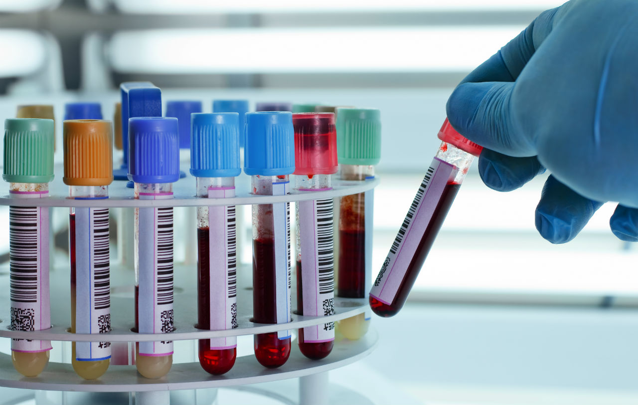 Cofece investiga a laboratorios y bancos de sangre fifu