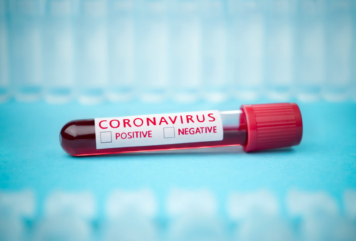 ¿Qué efectos tendrá la pandemia de coronavirus en la política global?