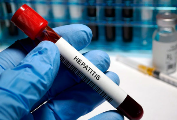 Hepatitis infantil aguda: Hidalgo registra primera muerte de menor por esta enfermedad