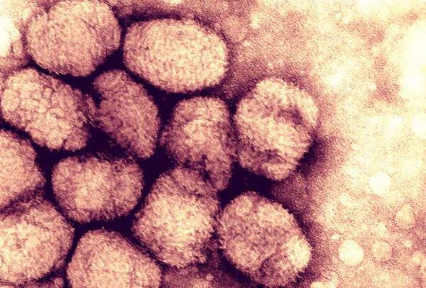 Surgirán más casos de la viruela del mono, advierte la OMS