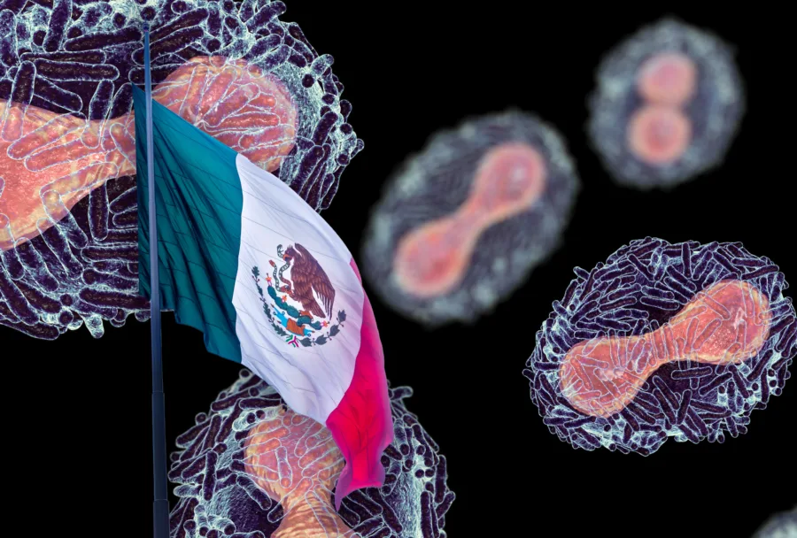 Viruela del mono: ¿Cuántos casos hay registrados en México? Viruela del mono: ¿Cuántos casos hay registrados en México?